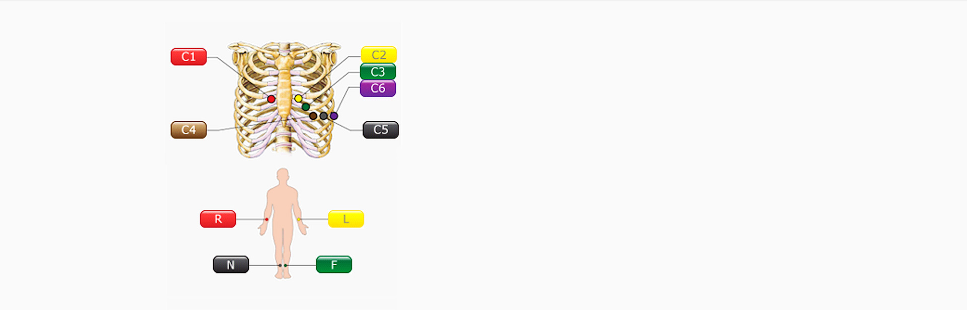 Схема отведений