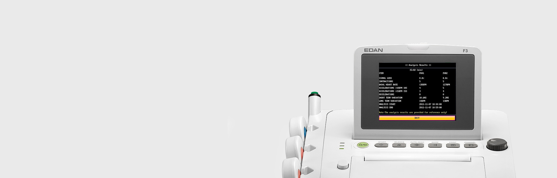 Встроенная система анализа КТГ