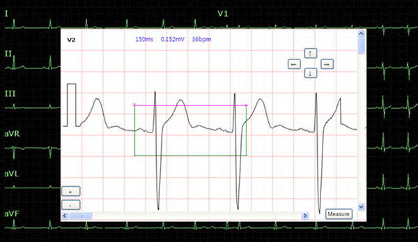 Измерения и диагностика на экране